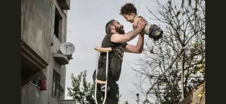 parte della foto Hardship of life che ritrae un papà senza una gamba, appoggiato ad una stampella, mentre gioca tenendo tra le braccia il figlio di 5 anni privo di braccia e di gambe