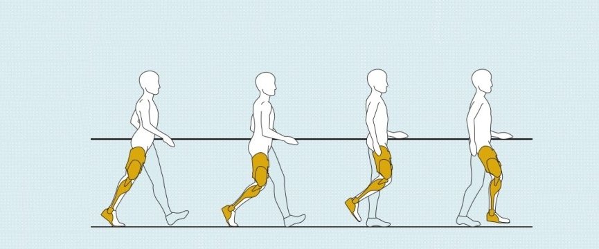 disegno che rappresenta una persona che indossa ortesi di gamba in varied fasi