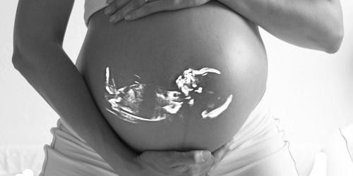 donna incinta con le mani sulla pancia e ecografia sulla pancia