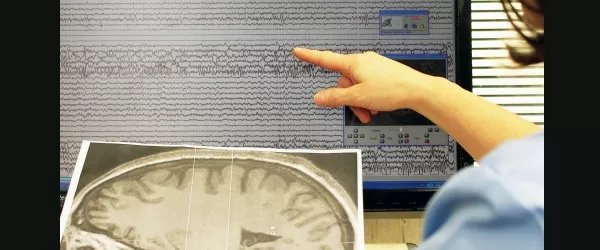 mano di un medico che sta osservando un tracciato cerebrale di epilessia