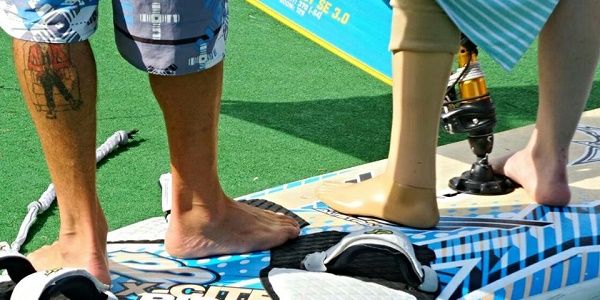 una gamba vicino ad una protesi su una tavola da windsurf